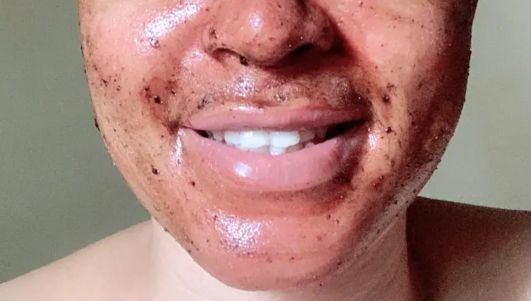 african black soap on face